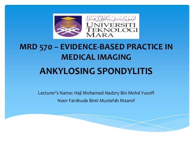 Ankylosing Spondylitis: In Clinical Practice